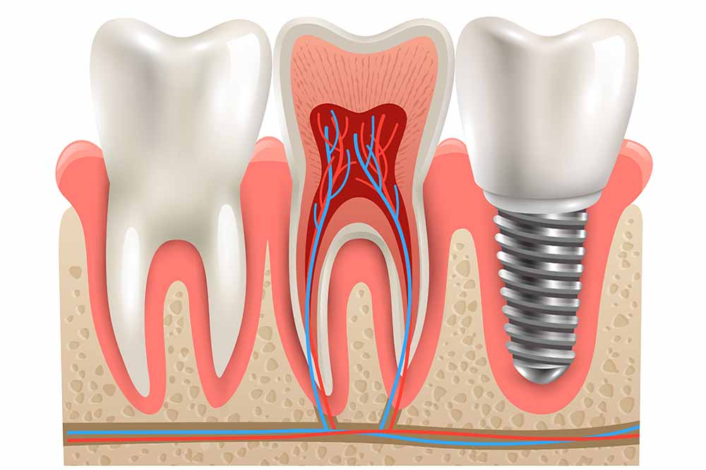 Dr. Khemka Dental Clinic