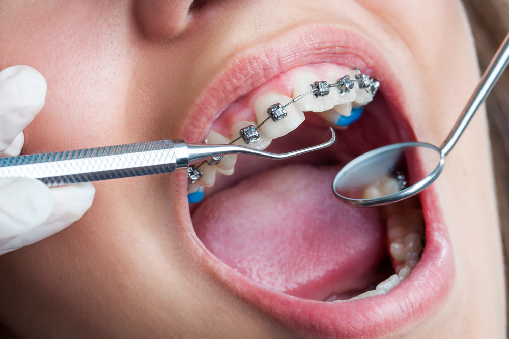 Dr. Khemka Dental Clinic