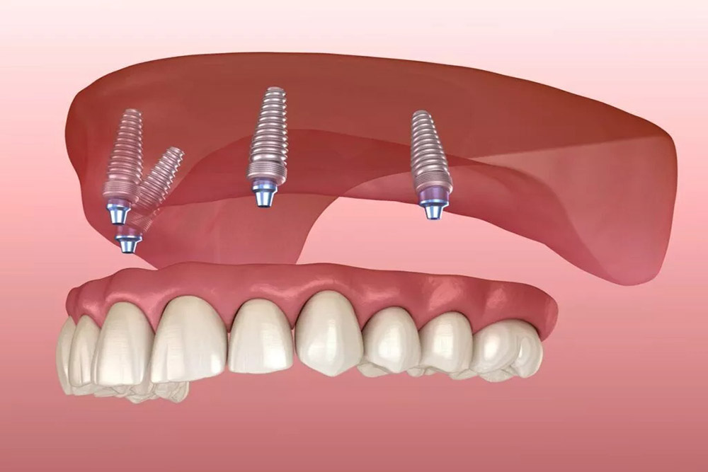 Dr. Khemka Dental Clinic